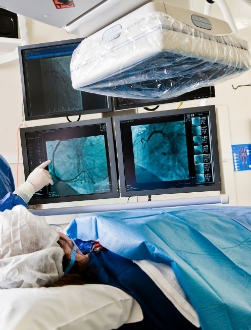 precio-de-estudio-de-cateterismo-cardiaco-en-guadalajara.jpg